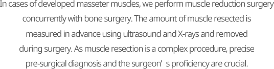 In cases of developed masseter muscles, we perform muscle reduction surgery concurrently with bone surgery. The amount of muscle resected is measured in advance using ultrasound and X-rays and removed during surgery. As muscle resection is a complex procedure, precise pre-surgical diagnosis and the surgeon’s proficiency are crucial.