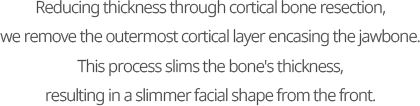 Reducing thickness through cortical bone resection, we remove the outermost cortical layer encasing the jawbone. This process slims the bone's thickness, resulting in a slimmer facial shape from the front.