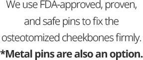 We use FDA-approved, proven, and safe pins to fix the osteotomized cheekbones firmly. *Metal pins are also an option.