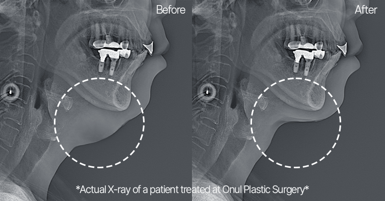 Precise Diagnosis for a Personalized Design